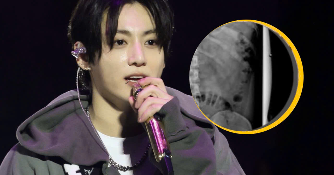Jungkook’s Incredible Performance After Revealing His Shin Injury Leaves ARMY in Awe